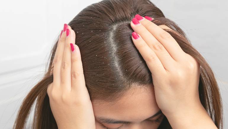 सर्दियों में बालों की ड्राईनेस से पाएं छुटकारा, अपनाएं ये आसान सा उपाय