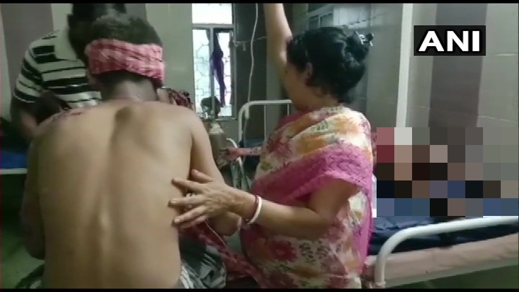 विधानसभा चुनाव से पहले ही पश्चिम बंगाल के रामपुर में बम ब्लास्ट, बीजेपी के 6 कार्यकर्ता घायल While the preparations of political parties are in full swing for the West Bengal Assembly elections, there is a furore due to the bomb blast