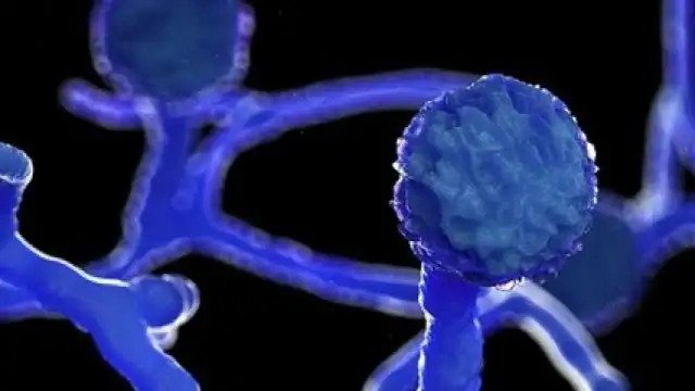 उत्तराखंड के एम्स ऋषिकेश में मिले ब्लैक फंगस के 42 मामलें A total of 42 patients of mucor mycosis (black fungus) have been detected in AIIMS Rishikesh. So far, a total of 2 people, including a woman,