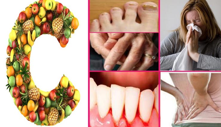 अगर शरीर में दिखे ये लक्षण तो समझ जाए विटामिन C की हो रही है कमी Vitamin C is considered very important for the body. Vitamin C is helpful in many types of chemical actions in the body,