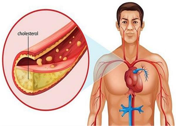 चालीस साल से कोलेस्ट्रॉल के नाम पर अरबो की ठगी… For forty years the world was being deceived in the name of cholesterol. American doctors, scientists and drug companies colluded to sell