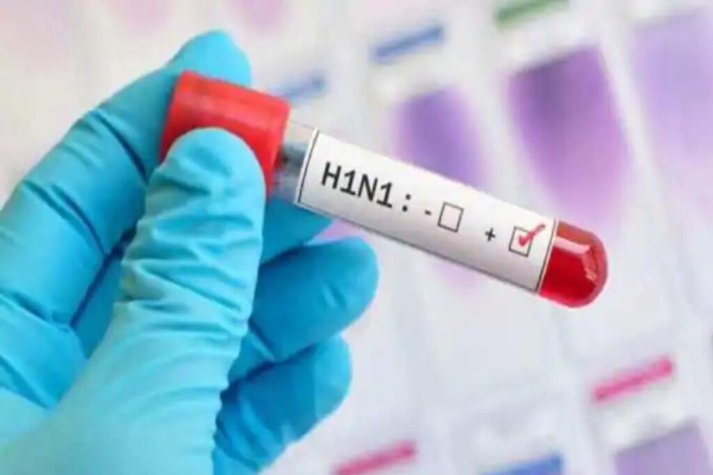 यूपी के 64 जिले स्वाइन फ्लू की चपेट में, नोएडा-गाजियाबाद में सबसे ज्यादा मामले; 2 की मौत