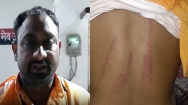 भगवा कुर्ता पहनकर पार्टी दफ्तर पहुंचा यूथ कांग्रेस का पूर्व जिला उपाध्यक्ष, पार्टी नेताओं की पिटाई