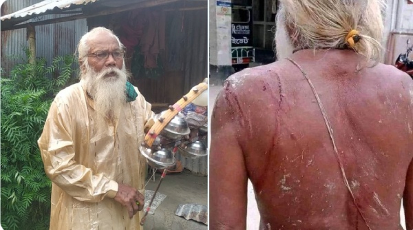 बांग्लादेश में हिंसा और तख्तापलट के बाद हालात की गंभीरता पर साधु बाबा का बयान