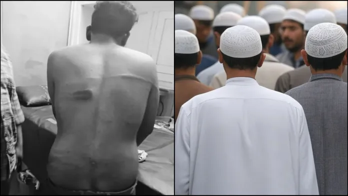 हैदराबाद में सांप्रदायिक हिंसा: मुस्लिम लड़की से बात करने पर साई चरण का अपहरण, बेरहमी से पिटाई, 9 पर FIR