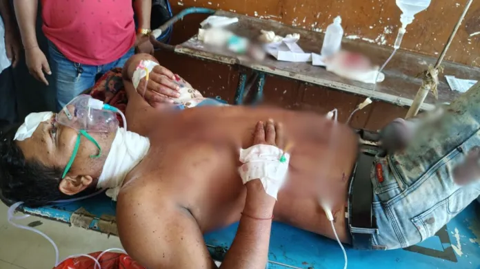 पश्चिम बंगाल: बीजेपी कार्यकर्ता पर उस्तरे से हमला, पार्टी ने टीएमसी और ममता पर साधा निशाना