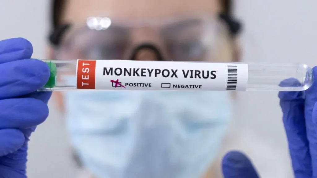 संकट में कूटनीति: अफ्रीका के दिल में फैले Mpox के बीच भारत का डेलीगेशन संकट में संकट में कूटनीति: अफ्रीका के दिल में फैले Mpox के बीच भारत का डेलीगेशन संकट में